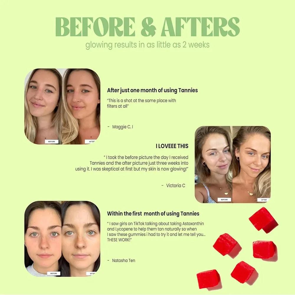 Gomas de bronzeamento - Suplemento de bronzeamento natural com astaxantina, licopeno e beta-caroteno - aumenta a melanina para uma pele radiante e com brilho — image 3