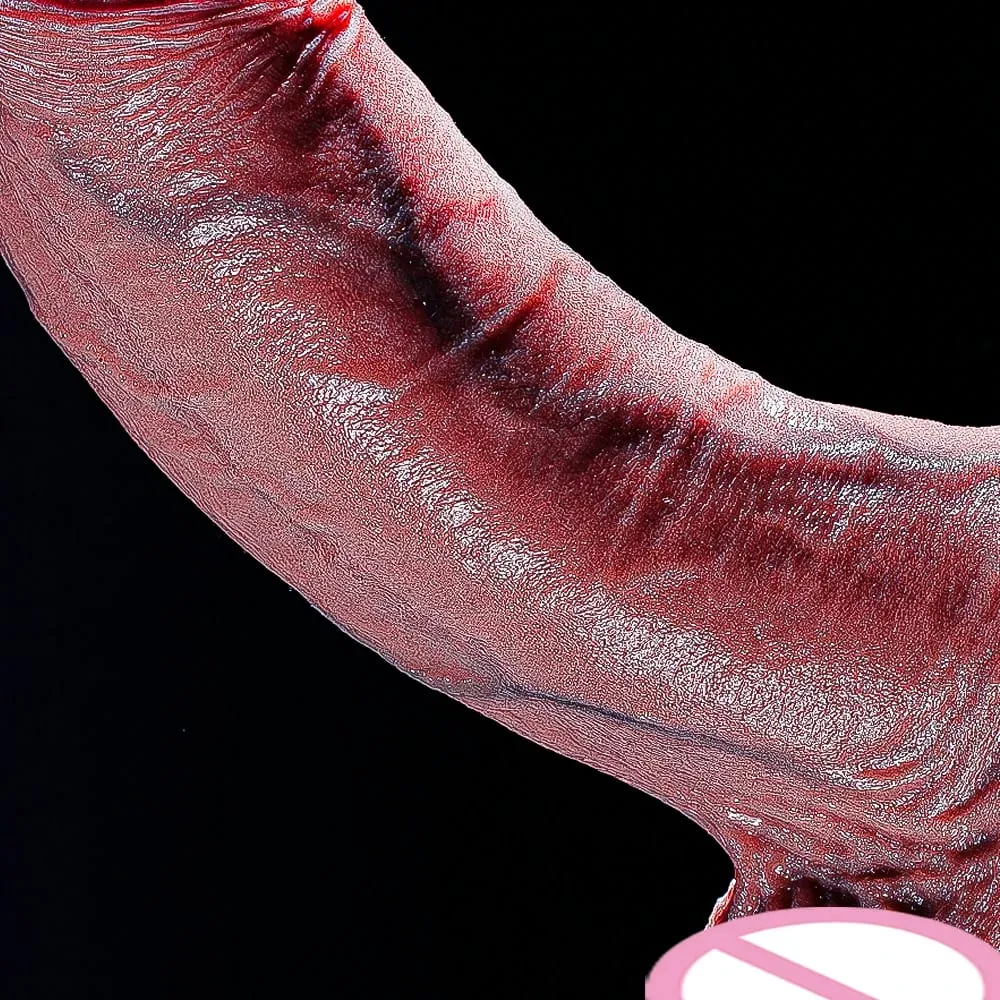 Fat Realistic Dildo Big Real Skin Silicone Huge Thick Dildo Giant Anal Soft Dildos with Suction Cup for Women Men G-spot Sex Toy — image 1