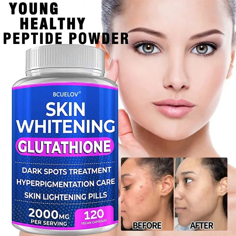 Kurkuma-Bärentraube-Vitamin-Gluthathion-Hautaufhellungspillen – 2000 mg – Gleicht freie Radikale aus und reduziert oxidativen Stress
